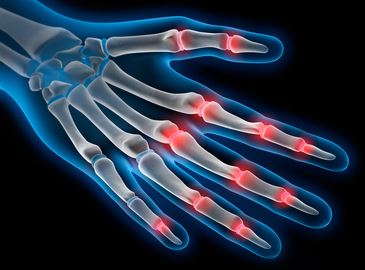 © psdesign1 - Fotolia.com